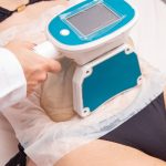 Obtenez des résultats spectaculaires avec la cryolipolyse à Toulon !